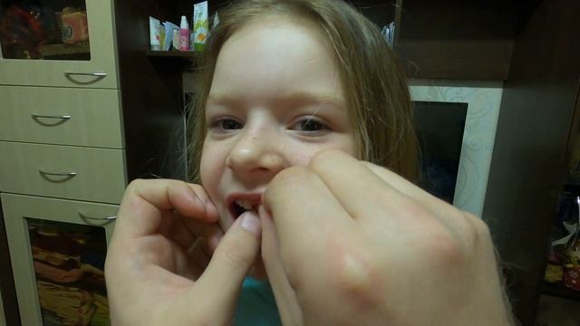 Вырываем Маше молочный зуб смотреть онлайн