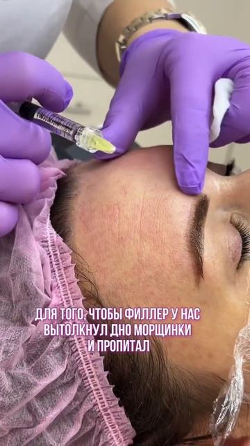 Выталкиваем дно морщин наружу и пропитываем кожу: #филлер+ #биоревитализант в одном шприце 💉