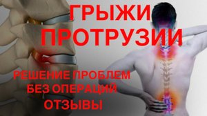 Грыжи. Протрузии. Решение проблем без операций. Отзывы.