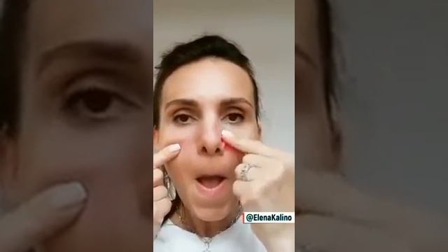 Тейпирование от заложенности смотреть онлайн