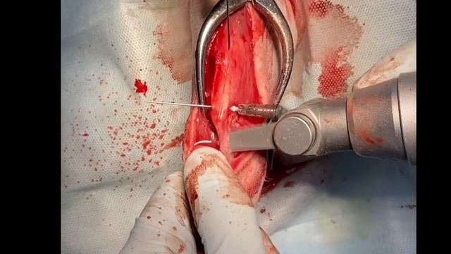 Транспозиция гребня большеберцовой кости собак/ Transposition Of The Tibial Tuberosity In Dog