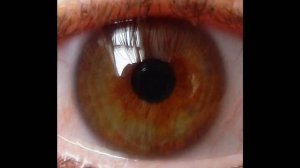 Лепетан Мор Фильм. Чудеса на Радужке глаз часть 1-А Первая в Мире галерея А.М. Кашпировского.