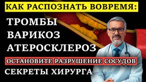 Тромбы, варикоз, атеросклероз - как распознать первые звоночки? как не допустить ампутации ноги?