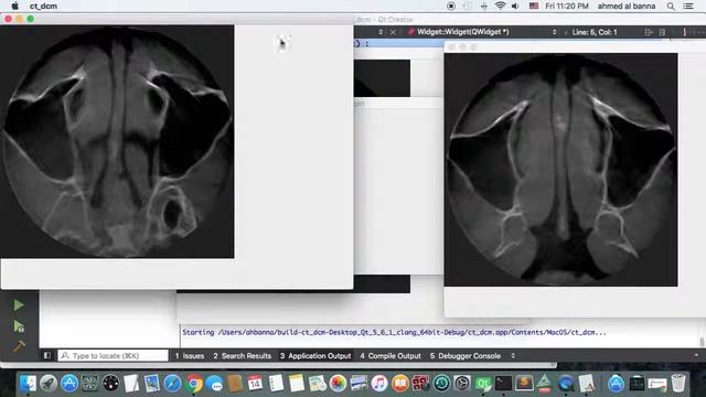 dcm dicom images qt + opencv +gsdcm смотреть онлайн