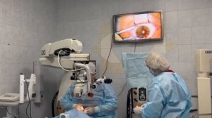 Операция локальный кросслинкинг по шагам. Случай из практики - лечение кератоконуса. Отзыв пациента.