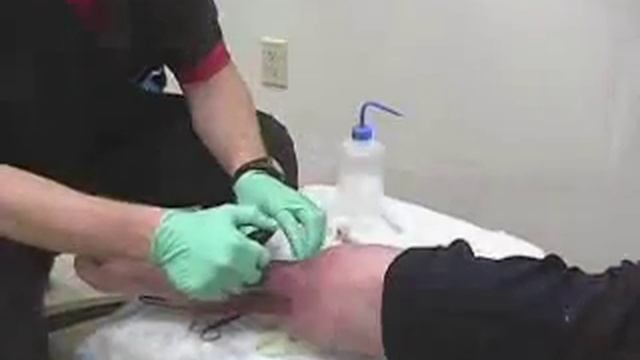 after maggot therapy смотреть онлайн