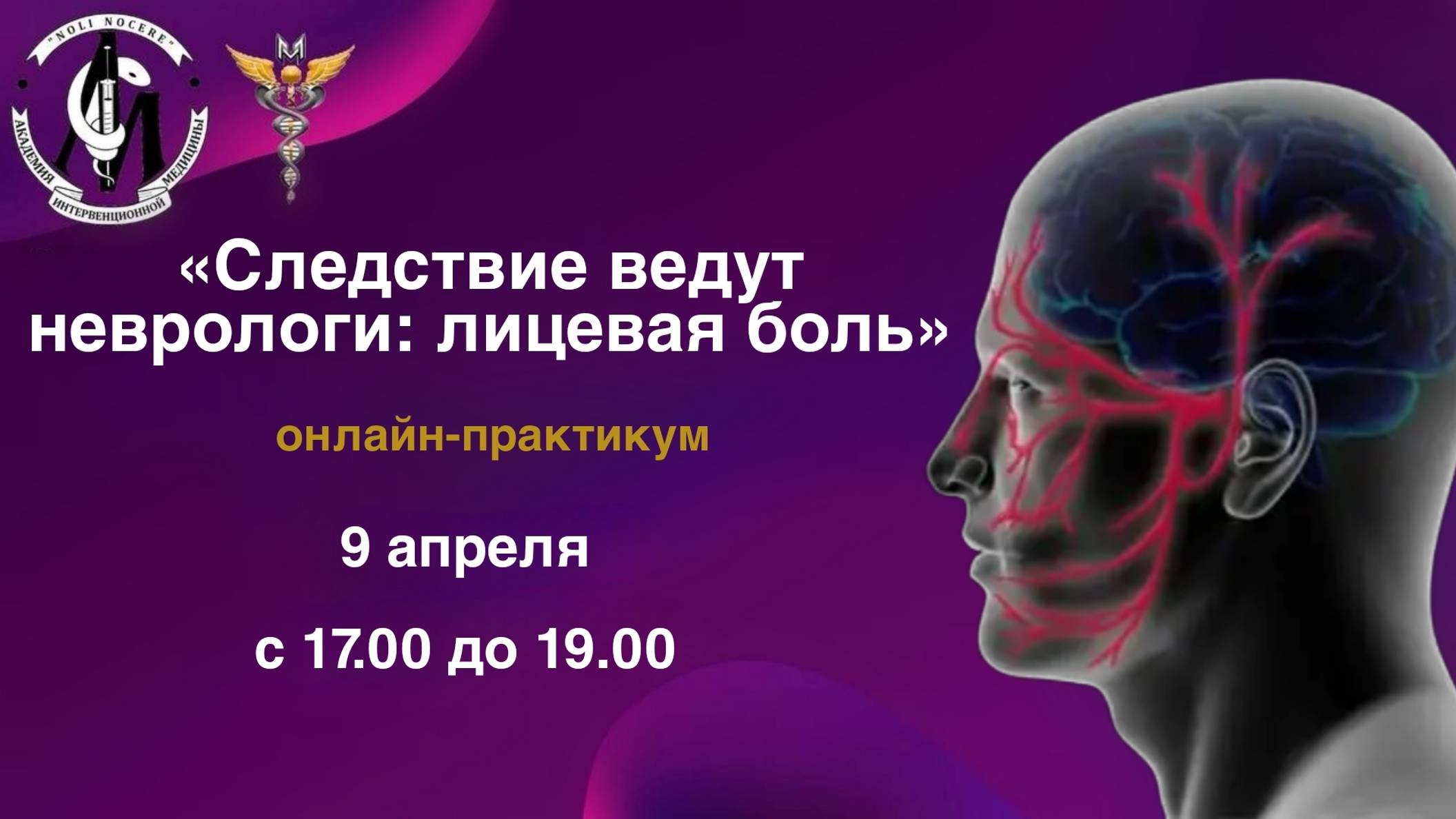 «Следствие ведут неврологи: лицевая боль»