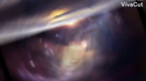 Вочи ноу барроу