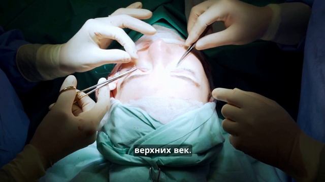 Операция глазных век Asklepion – комплексное преображение смотреть онлайн