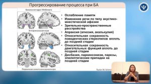 Болезнь Альцгеймера ч.1