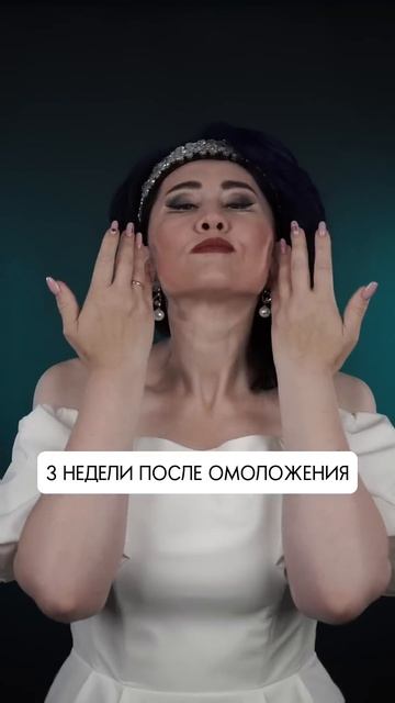 Похудела на 72 кг лицо обвисло😱 Фейслифтинг. Эндоскопическая подтяжка лба и бровей. Док ТУМАКОВ Г.И