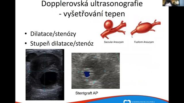 Anatomie v angiologii смотреть онлайн