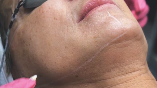 SKIN Prince George | IPL | Vancouver Video Production | Citrus Pie Media Group