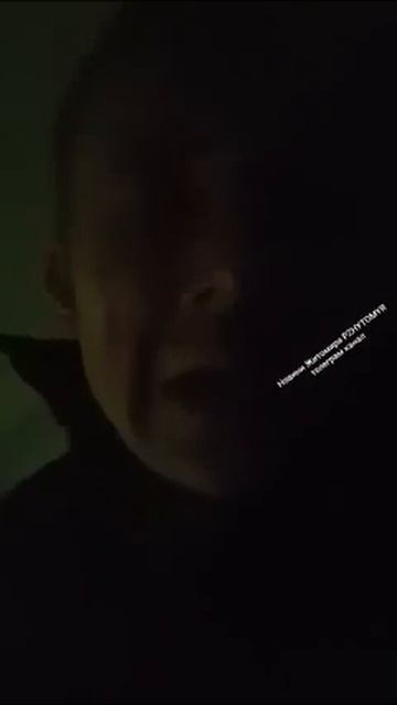 Житель Житомира Михаил Матвейчук с следами крови на лице заявляет, что его ударили в местном ТЦК смотреть онлайн