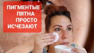 Тёмные пятна на лице убираю просто.Домашняя простая маска от пигментных пятен на коже.