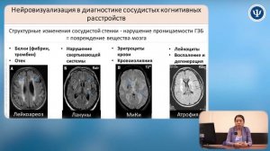 БА-сосудистая или смешан Деменция часть 1