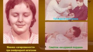 Симптом Рюмке