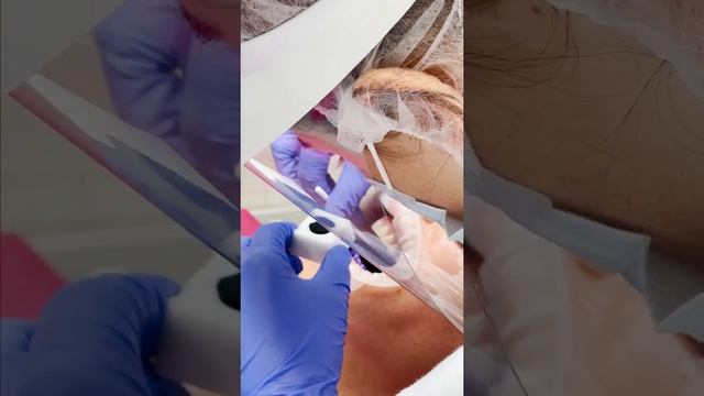 ➡ Профессиональная гигиена полости рта