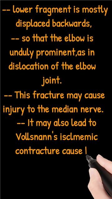 Clinical anatomy of Humerus Bone#anatomy #upperlimb #bonesofupperlimb #upperlimbanatomy смотреть онлайн