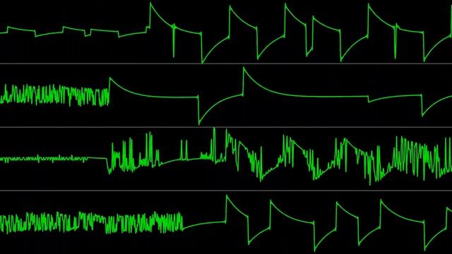 Łukasz Sychowicz (X-Ray) - "Cabil" [Atari 8-bit] (Chiptune Visualization) смотреть онлайн
