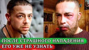 ТОЛЬКО ПОСМОТРИТЕ, КАК ИЗМЕНИЛСЯ! ЧТО СТАЛО СО ЗВЕЗДОЙ СЕРИАЛА "СЛЕД" | Актёр Андрей Лавров