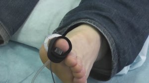 Измерение Пальце-плечевого индекса - ППИ (TBI)