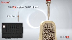 New SLIMEX - Surgical Procedure Video