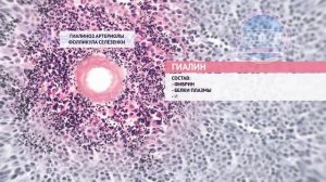 M047   Стромально   сосудистые мезенхимальные дистрофии