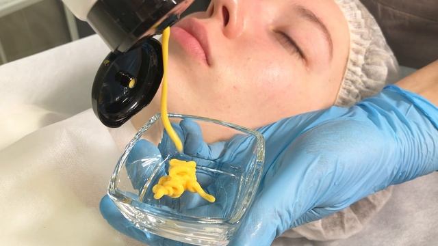 Уход PHILOSOPHY BIOSENSITIVE при розацеа и куперозе – деликатное восстановление кожи