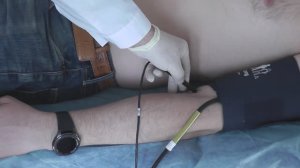 Измерение Лодыжечно-плечевого индекса - ЛПИ (ABI)