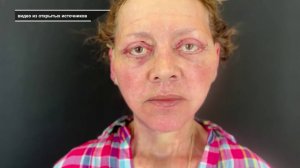 КЛИНИКА «МЕДИЧИ» ОПЕРИРОВАЛА ПАЦИЕНТОВ БЕЗ ЛИЦЕНЗИИ