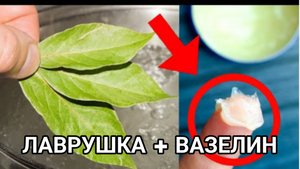Копеечный рецепт. ЛАВРОВЫЙ ЛИСТ + ВАЗЕЛИН. В 65 бегают, как в 25