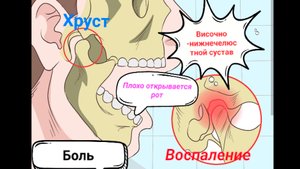 Височно-нижнечелюстной сустав, дисфункция. Хруст, боль, тугоподвижность нижней  челюсти.