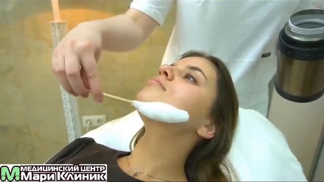 Криомассаж