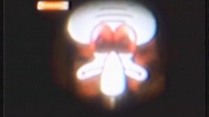 взлом канала Nickelodeon 31 декабря 2008 года