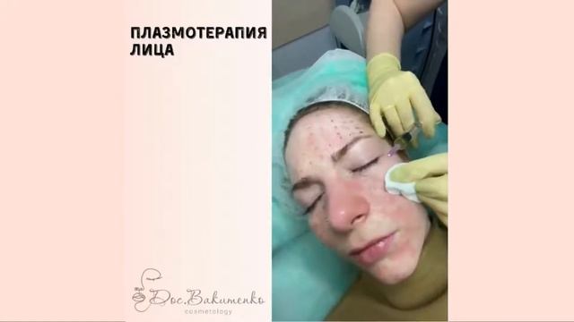 Все что нужно знать о плазмотерапии