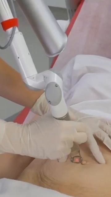 Say Goodbye to Stretchmarks: LineLase™ Secrets for Tighter, Radiant Skin!  | Vancouver Medi Spa