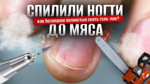 СПИЛИЛИ НОГТИ ДО МЯСА
