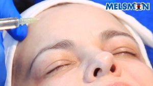 Melsmon "Лаковая кожа"