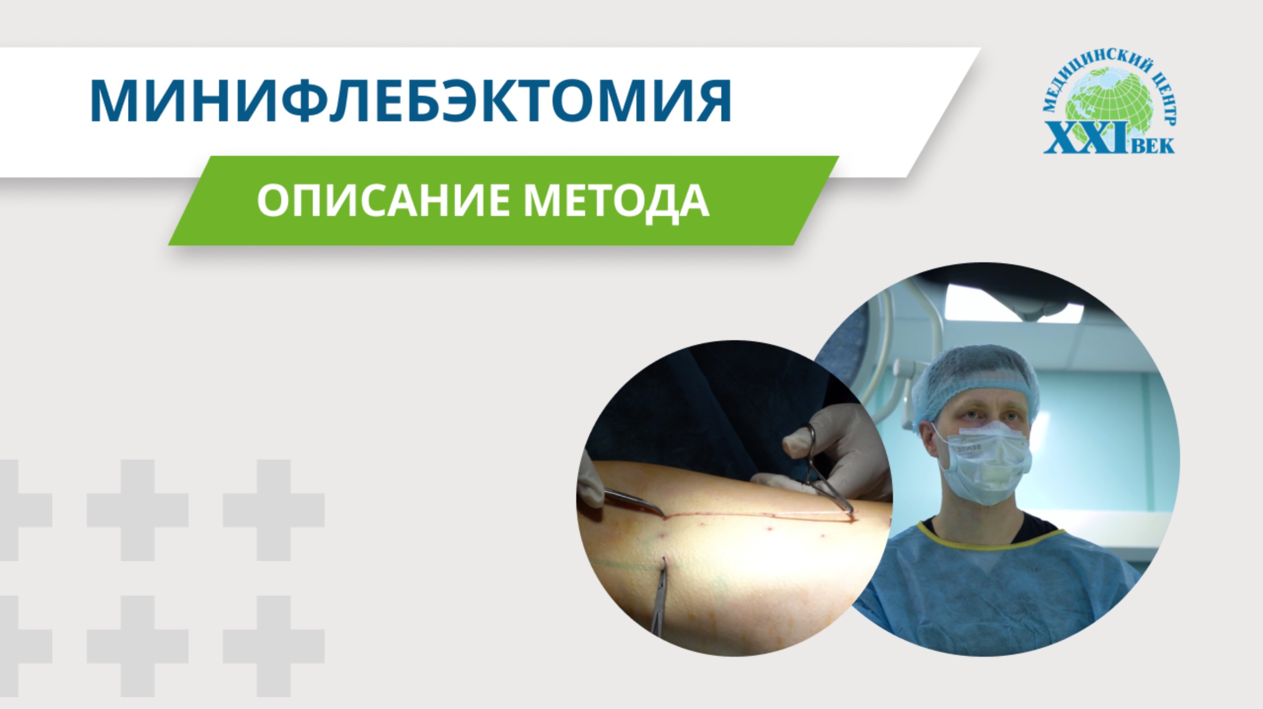 Минифлебэктомия | Медицинский центр «XXI век»