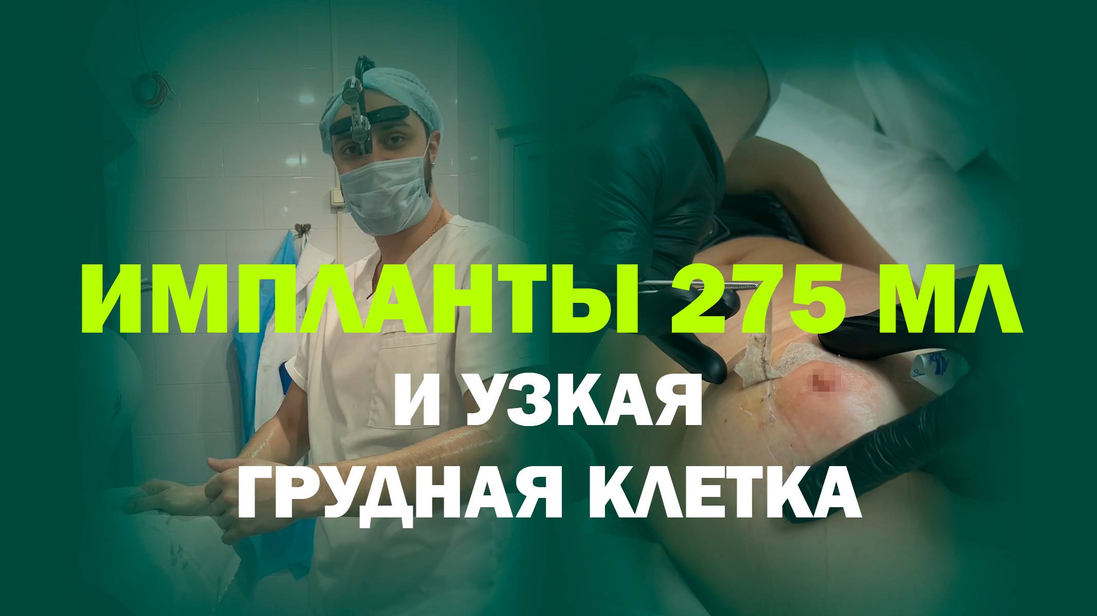 Увеличение груди: 275 мл для естественного результата