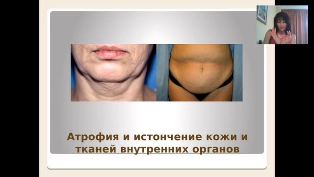 Ольга Левонюк - 3-й день интенсива  «Матрица Молодости, или Как запустить Время вспять». 03.06.16 смотреть онлайн