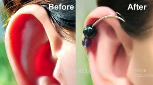 Как надеть каффы-корректоры на уши. Решение для торчащих лопоухих ушей. Виды  корректоров