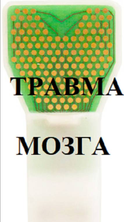 ЧМТ, контузия, химическая травма мозга. Восстановление нарушенных нейронных связей с НейроПорт