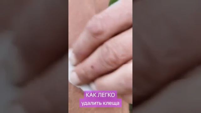VID-20250329-WA0684