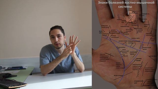 Диагностика варикоза с помощью хиромантии, ОПЫТ ВРАЧА !