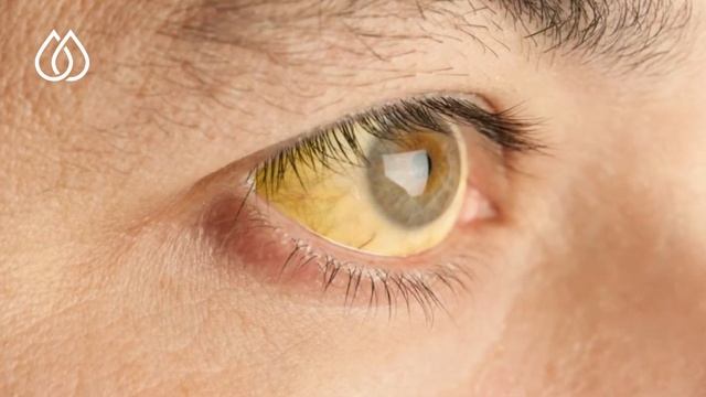 Dr. Xuraman Cəfərova - Drepanotalassemiya смотреть онлайн