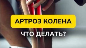АРТРОЗ КОЛЕНА. ЧТО ДЕЛАТЬ?