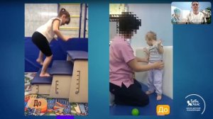 8 двигательных дефицитов