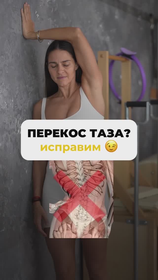 Перекос таза? Исправим! Подпишись и читай описание ✅